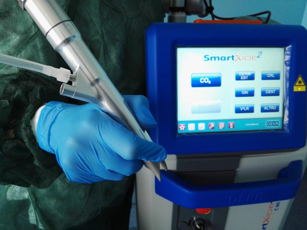 Laser SmartXide2 CO2